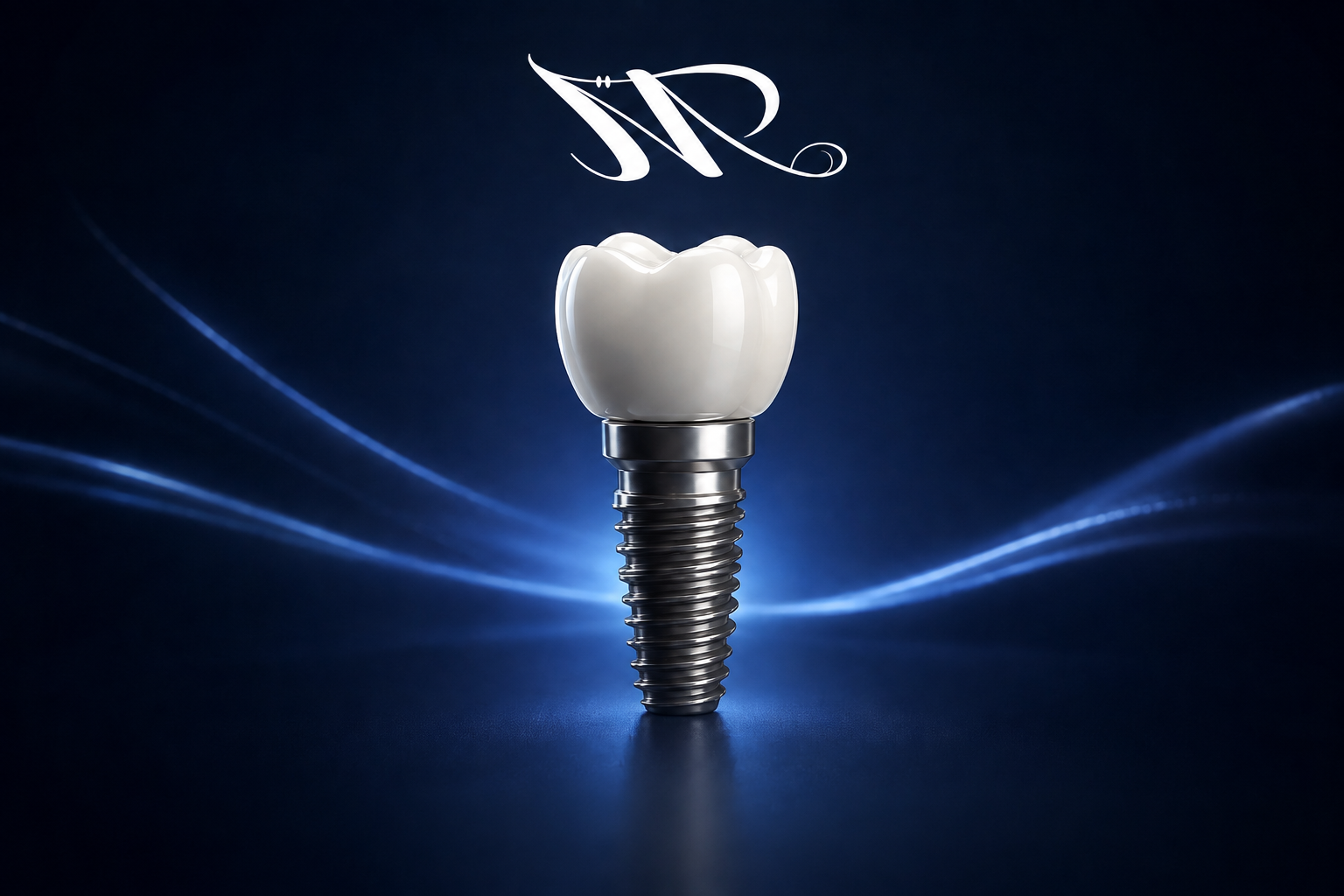 Implantes Dentários